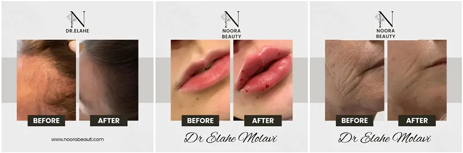 الهه مولوی یکی از بهترین دکتر پی ار پی در مشهد است