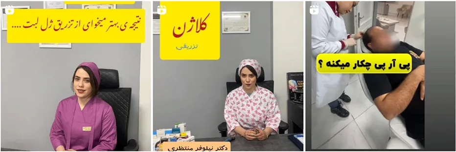 کلینیک زیبایی نیلوفر منتظری یکی از بهترین کلینیک پی ار پی در مشهد است