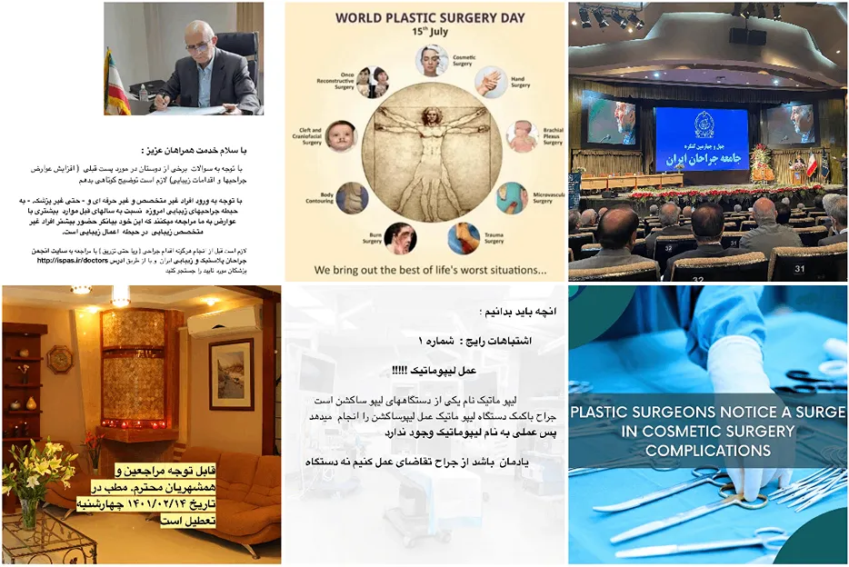 دکتر سنجر از بهترین دکتر تزریق چربی در مشهد است