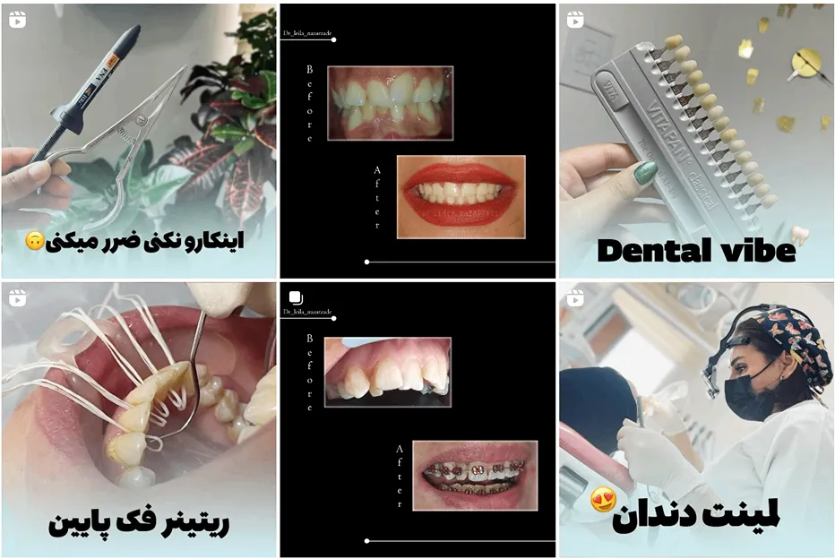 دکتر نظرزاده از بهترین متخصص ایمپلنت در مشهد است