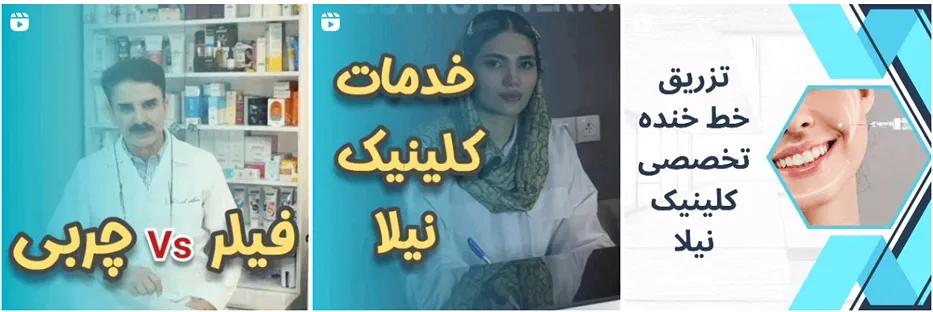 پی ار پی در مشهد توسط کلینیک نیلا کاملا قابل انجام است