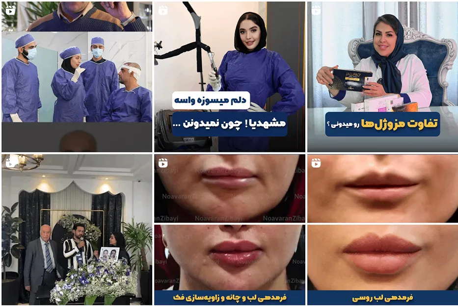 کربوکسی تراپی در مشهد توسط کلینیک نوآوران زیبایی کاما قابل انجام است