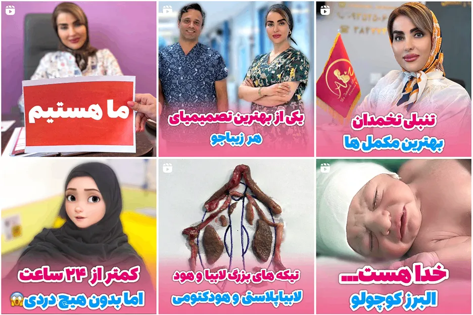 لابیاپلاستی در مشهد توسط دکتر آذرپرند قابل انجام است