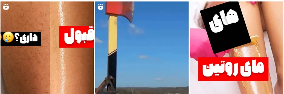 اپیلاسیون در مشهد توسط سرکار خانم رمضانی قابل انجام است