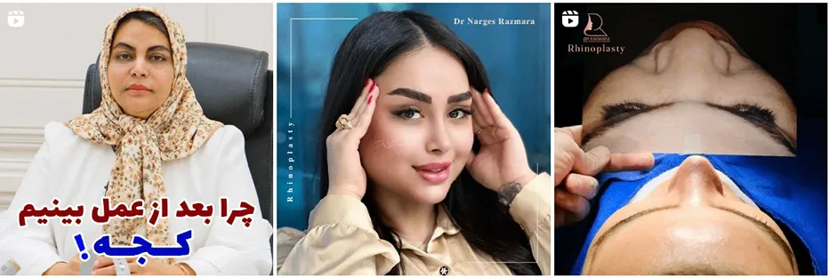 دکتر رزم آرا یکی از بهرتین دکتر بلفاروپلاستی در مشهد است