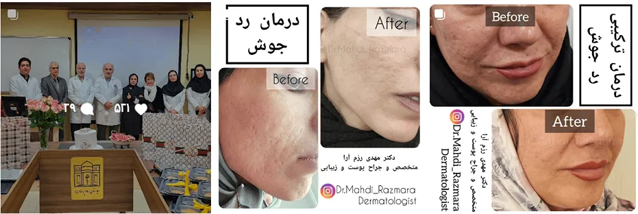 دکتر مهدی رزم آرا یکی از بهترین دکتر پی ار پی در مشهد است