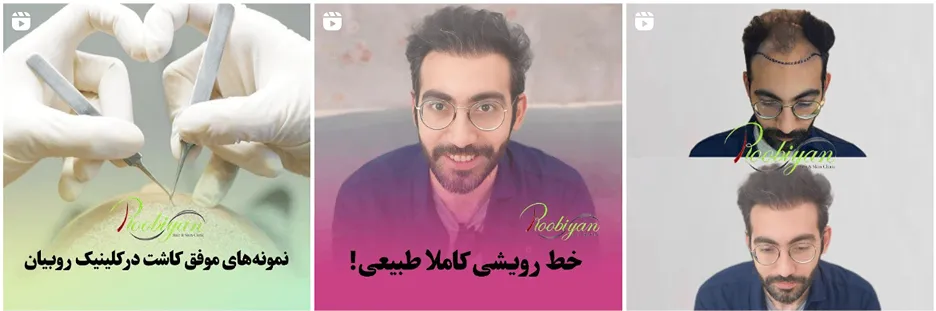 کلینیک زیبایی روبیان یکی از بهرتین کلینیک پی ار پی در مشهد است