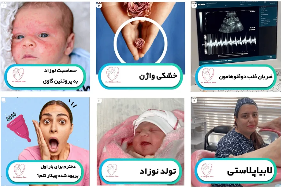 دکتر ریخته گران از بهترین دکتر لابیاپلاستی در مشهد است