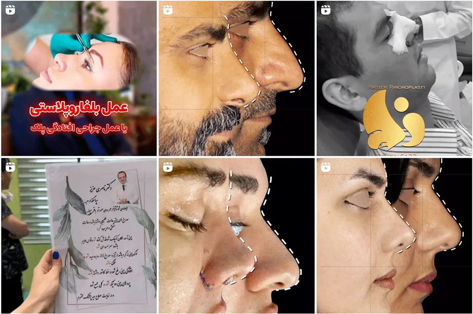 دکتر صدر از بهترین جراح بینی مشهد است