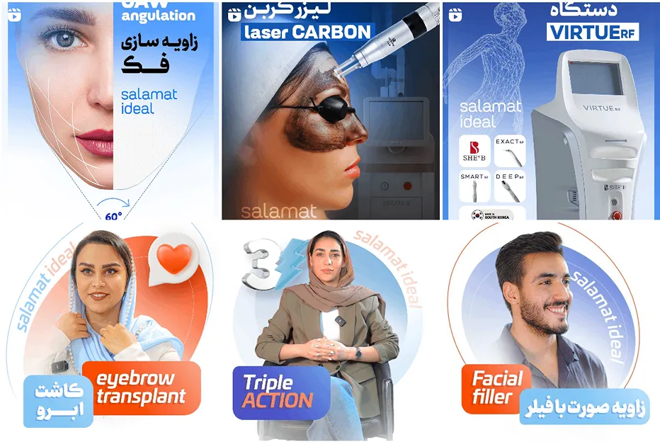 کلینیک سلامت اید ال از بهترین کلینیک لیزر در مشهد است