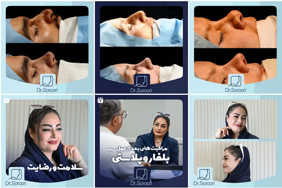 عمل بینی در مشهد توسط دکتر سروری قابل انجام است