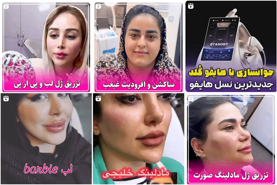 کربوکسی تراپی در مشهد توسط کلینیک سایه کاملا قابل اجرا است