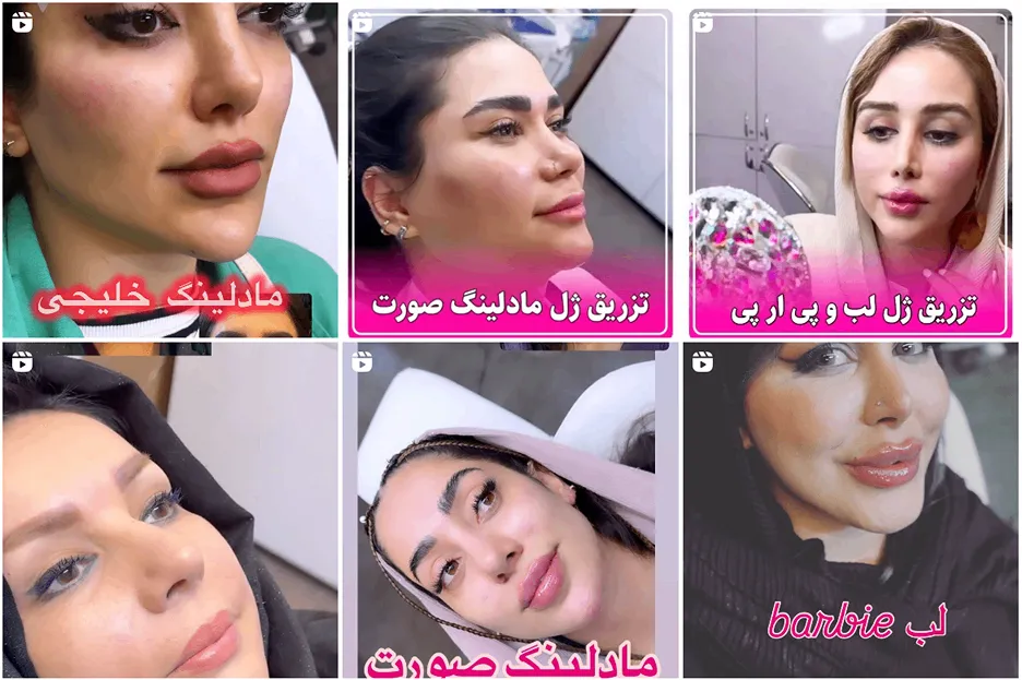 کانتورینگ صورت مشهد در کلینیک زیبایی سایه قابل انجام است