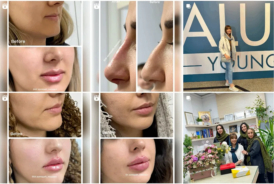 کربوکسی تراپی در مشهد در نزد دکتر موسوی کاملا قابل انجام است