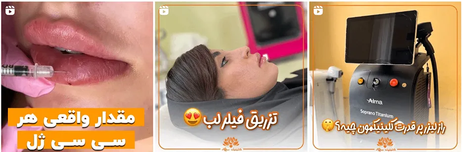 کلینیک سی گل یکی از کلینیک زیبایی مشهد است