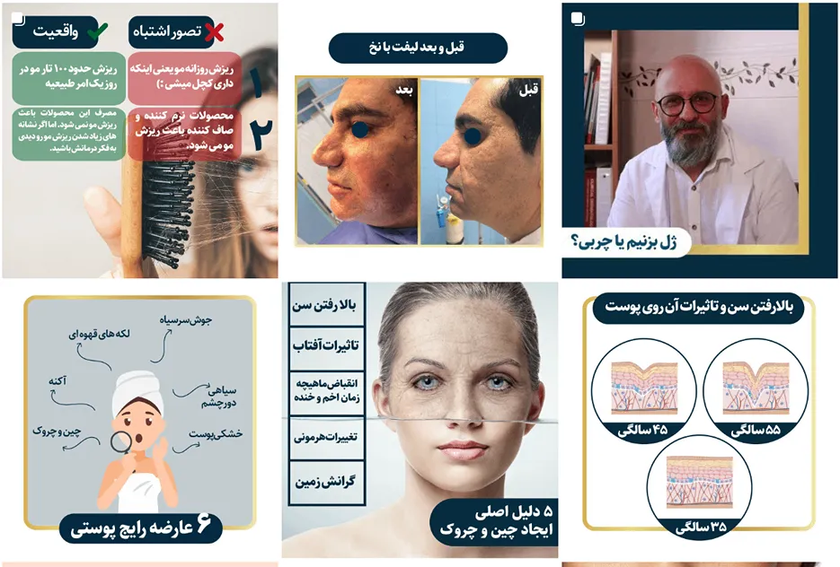 دکتر سپهر از بهرتین دکتر پوست و مو در مشهد است