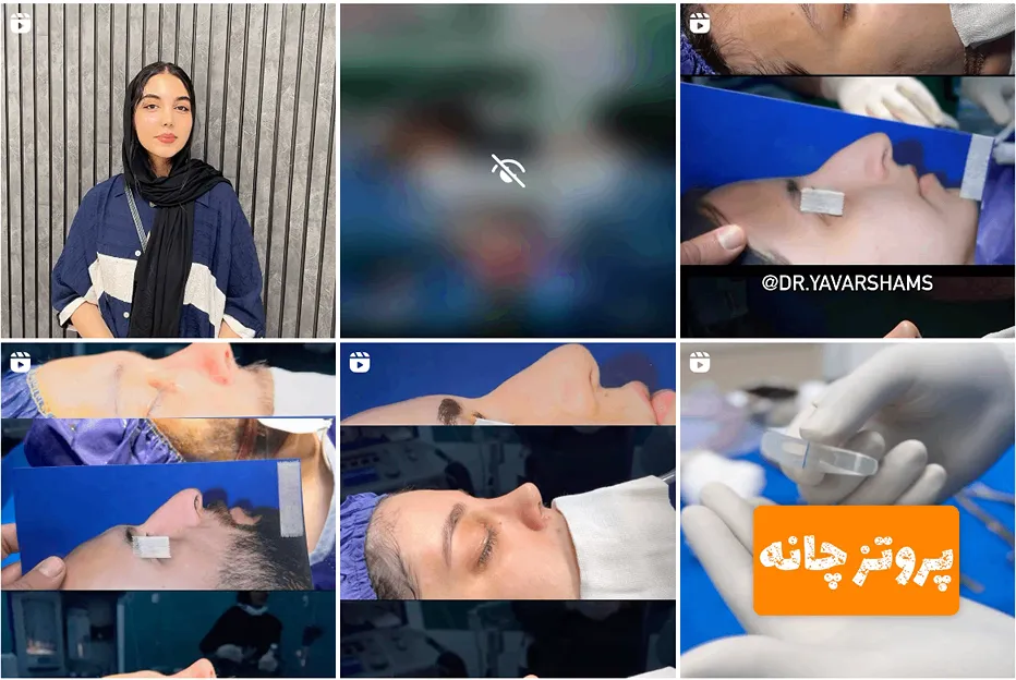 دکتر شمس از بهترین دکتر جراح بینی در مشهد است