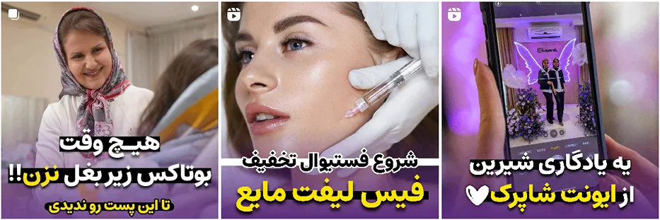 تزریق بوتاکس در مشهد در کلینیک زیبایی شاپرک قابل انجام است
