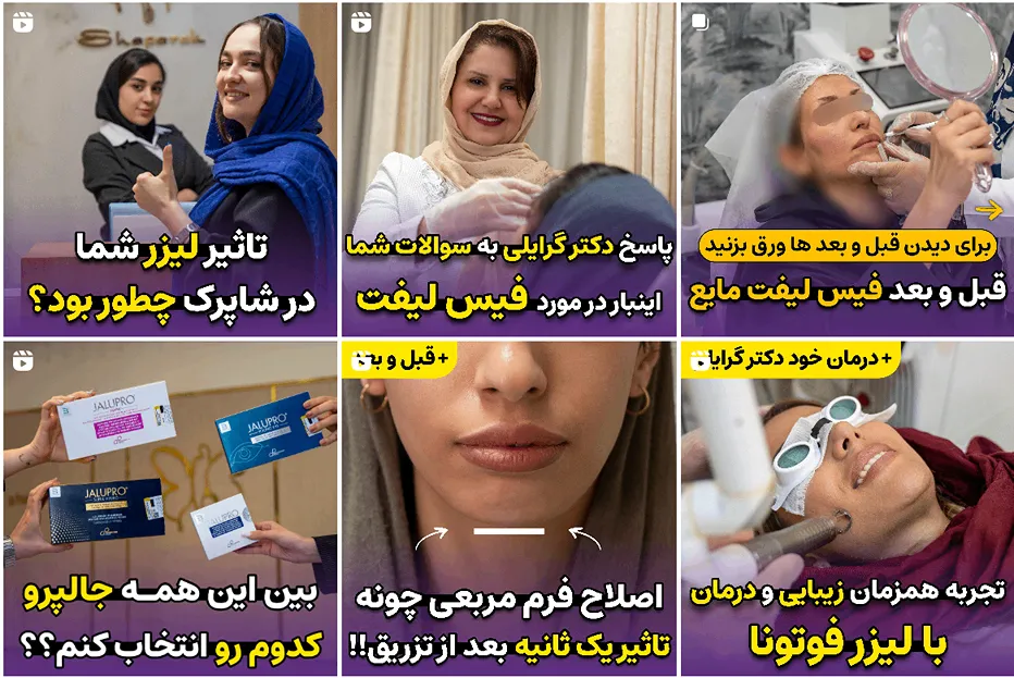 کلینیک زیبایی شاپرک از بهرتین کلینیک لیزر موهای زائد در مشهد است