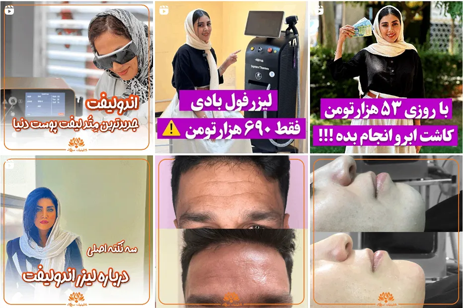 تصویر بهترین مرکز لیزر در مشهد را مشاهده میفرمایید