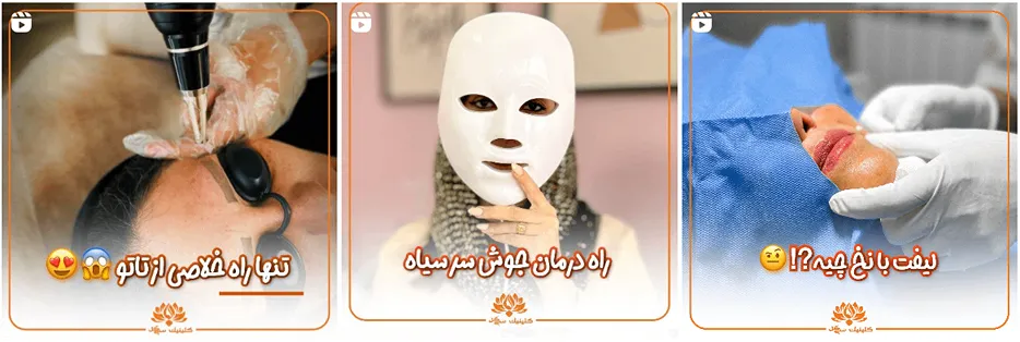 میکرونیدلینگ در مشهد توسط کلینیک سی گل قابل انجام است