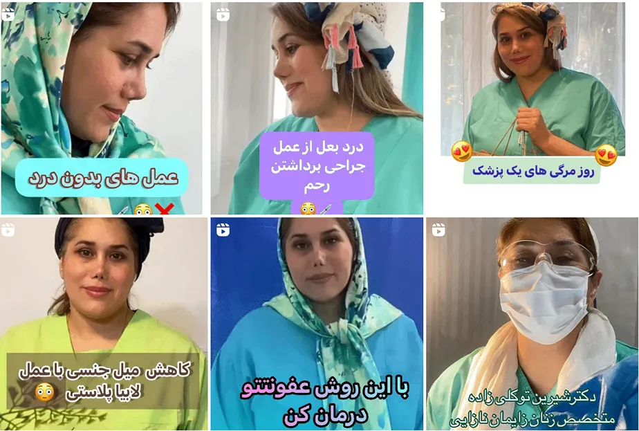 لابیاپلاستی در مشهد توسط دکتر توکلی زاده قابل انجام است