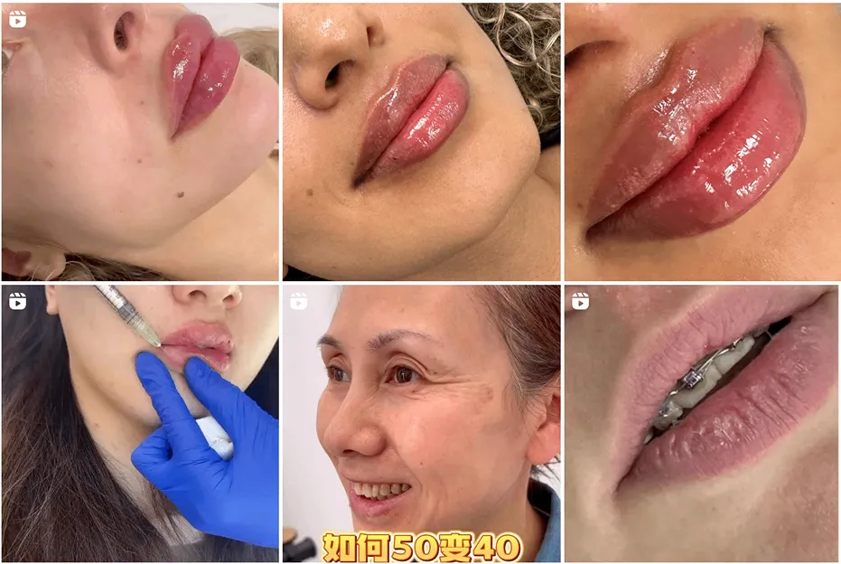 دکتر تیموری یکی از بهترین دکتر اندولیفت در مشهد است