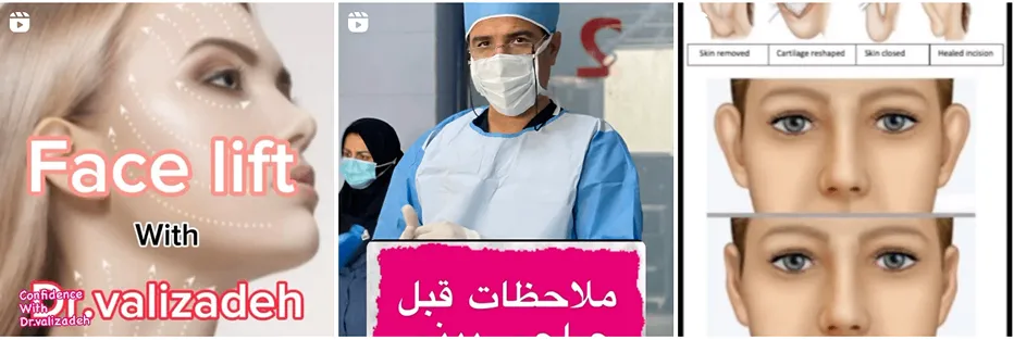 دکتر ولی زاده مقدم از بهترین متخصصین لیفت صورت در مشهد است