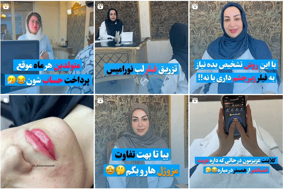 نمونه کار یکی از بهترین مرکز کربوکسی تراپی در مشهد را مشاهده میفرمایید.