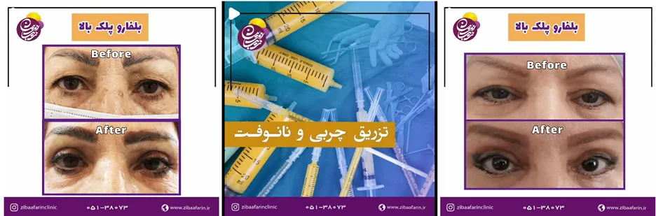 کلینیک زیبا آفرین یکی از بهترین کلینیک زیبایی مشهد است
