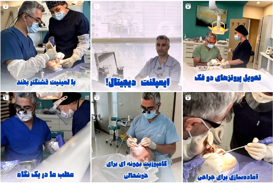 لمینت در مشهد توسط دکتر ازادگان قابل انجام است