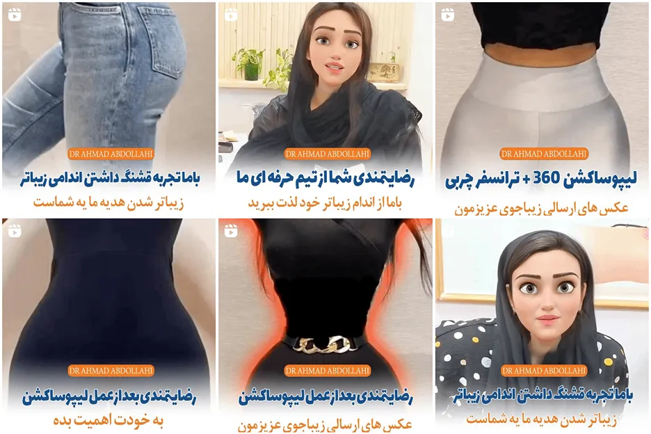 عمل ژنیکوماستی در مشهد توسط دکتر عبداللهی کاملا قابل انجام است