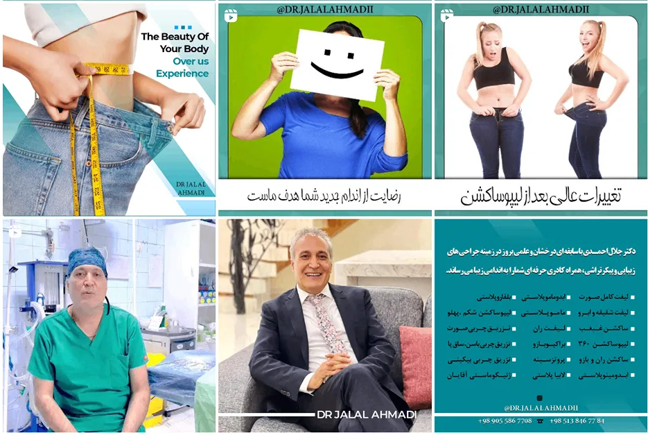 دکتر حدادی یکی از بهترین دکتر ژنیکوماستی در مشهد است