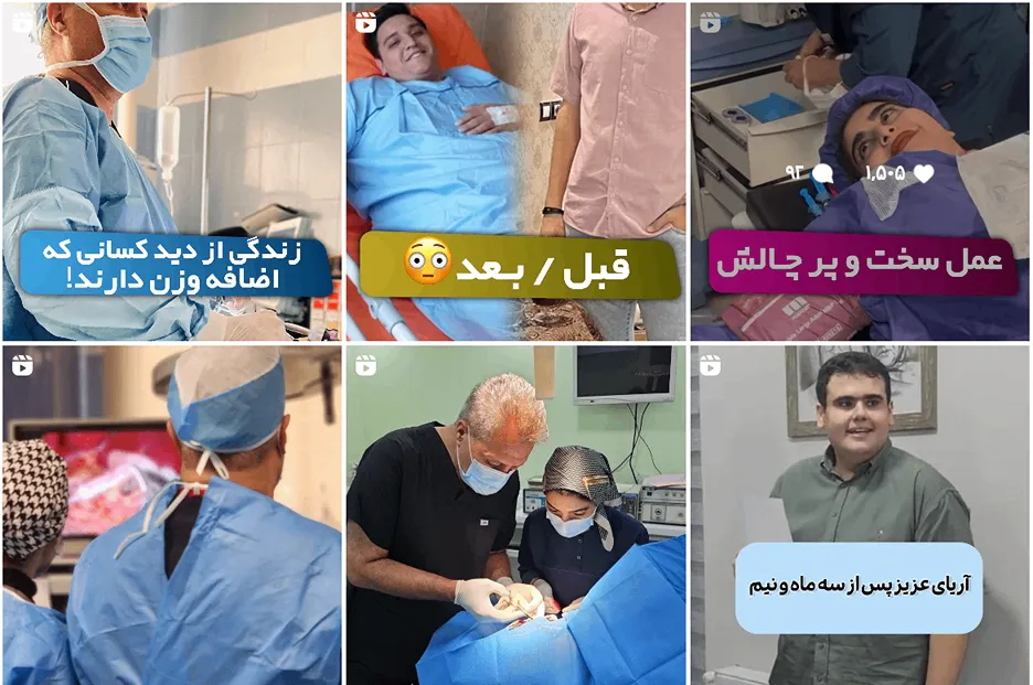 عمل لاغری معده در مشهد توسط دکتر اعلمی قابل رزرو است