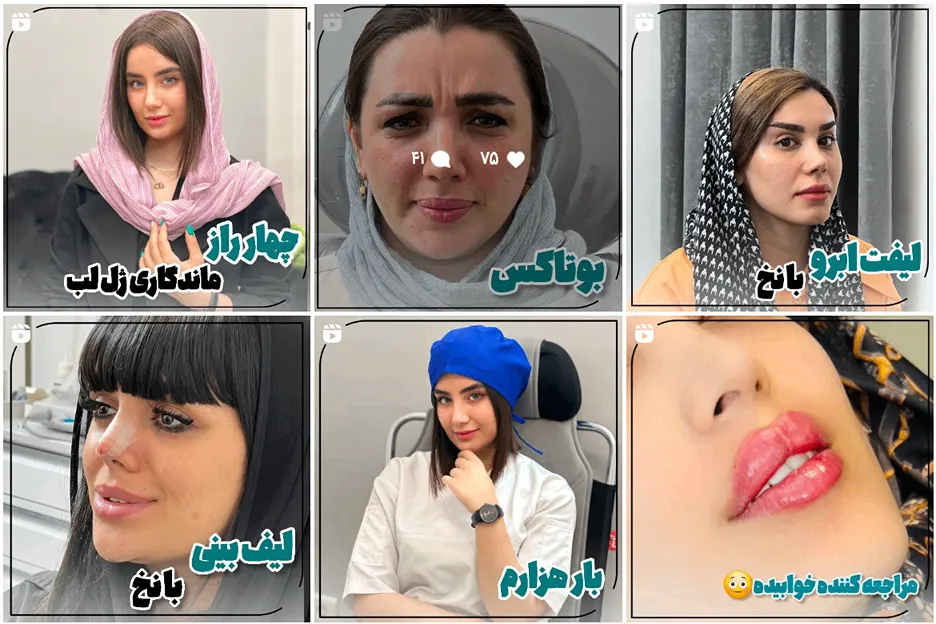 تصویر یکی از بهترین کلینیک لیفت با نخ در مشهد را مشاهده میفرمایید.