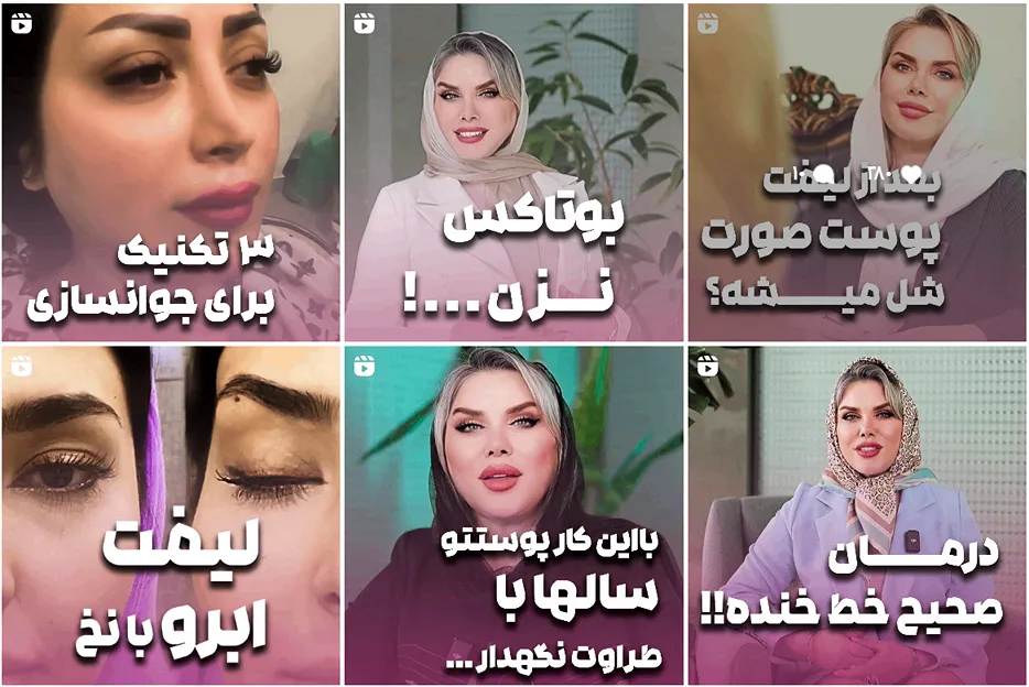 لیفت با نخ در مشهد توسط دکتر ارجمند کاملا قابل انجام است