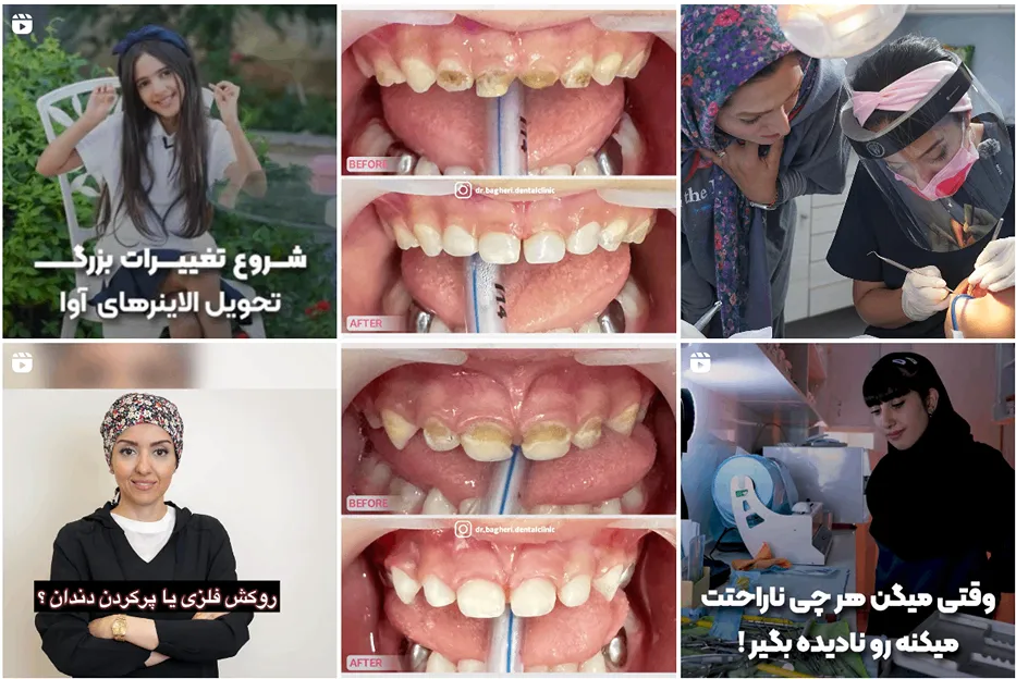 دندان پزشک کودکان در مشهد توسط دکتر باقری کاملا قابل انجام است