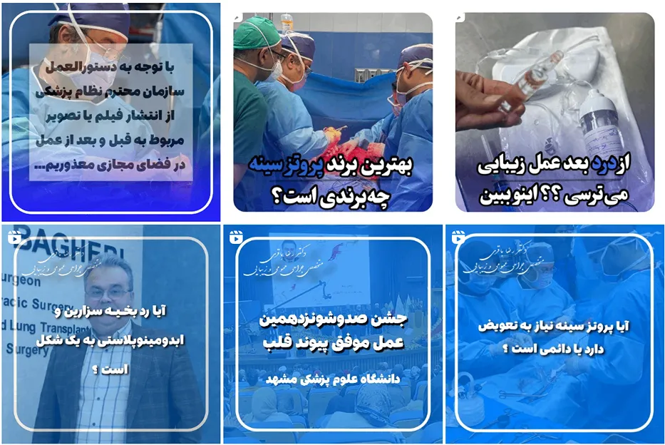 ژنیکوماستی در مشهد توسط دکتر باقری کاملا قابل انجام است