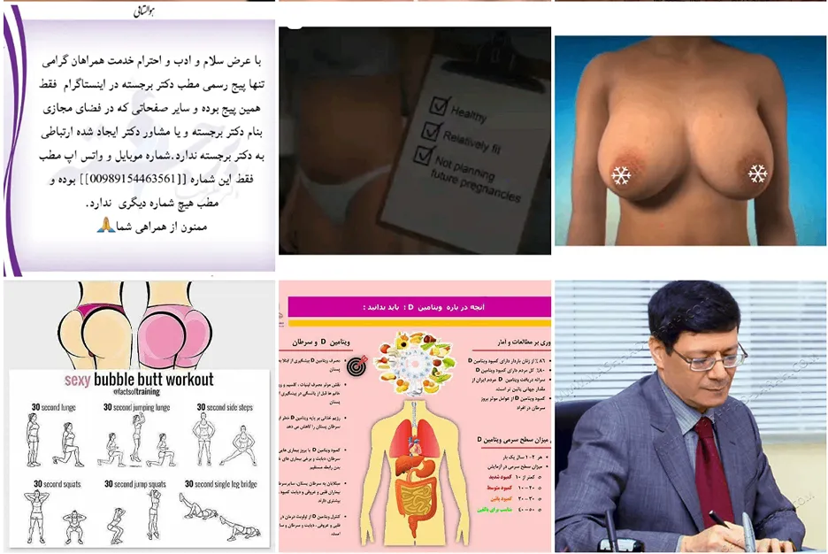 ابدومینوپلاستی در مشهد توسط دکتر برجسته قابل انجام است