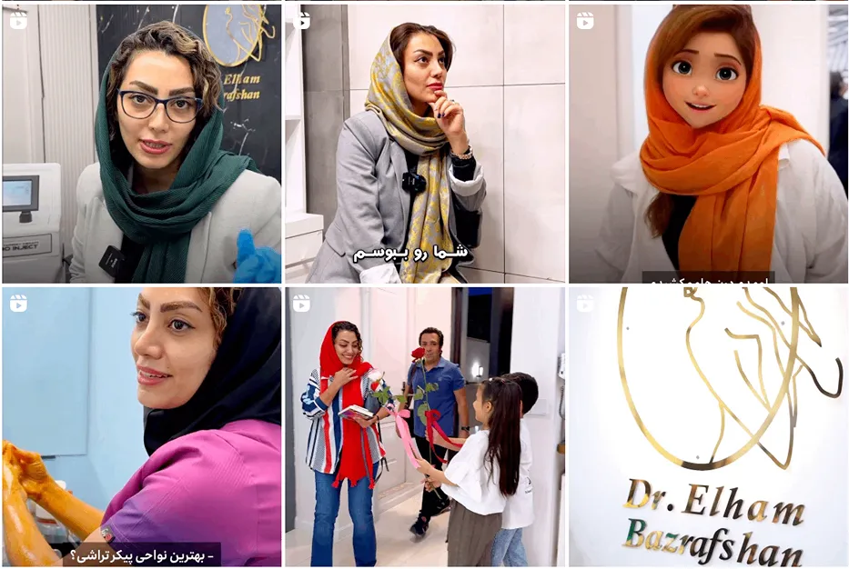 عمل ماموپلاستی در مشهد توسط دکتر بذرافشان قابل انجام است