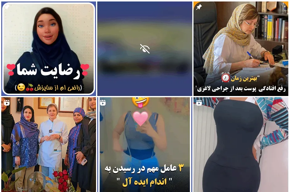 پروتز باسن در مشهد توسط دکتر دانشوری قابل انجام است