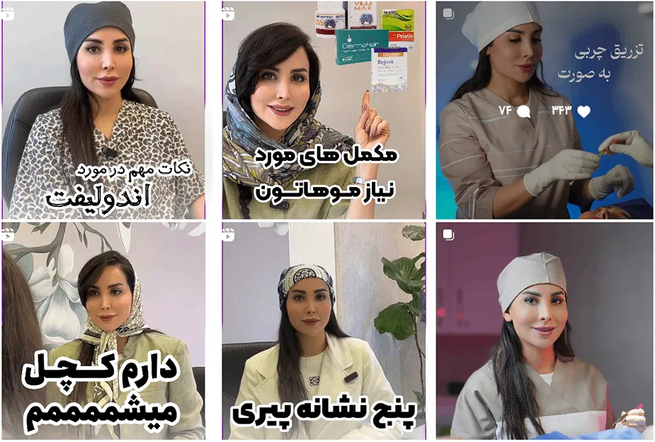 لیفت با نخ در مشهد توسط دکتر دقتندی کاملا قابل انجام است