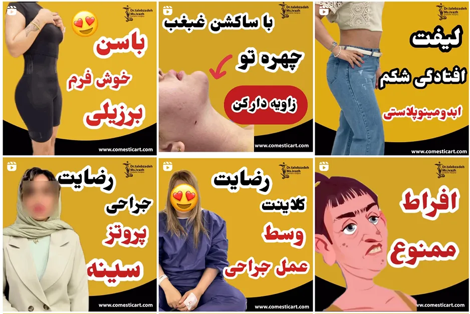 کلینیک ایواز دارای بهرتین دکتر پروتز باسن در مشهد است