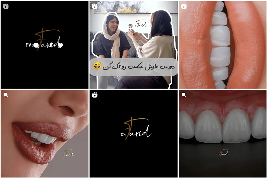 کامپوزیت دندان مشهد توسط دکتر فاضلی قابل انجام است
