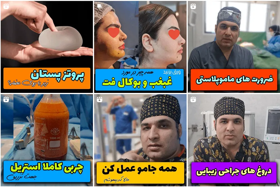 عمل کوپک کردن سینه در مشهد توسط دکتر گل محمدی قال انجام است