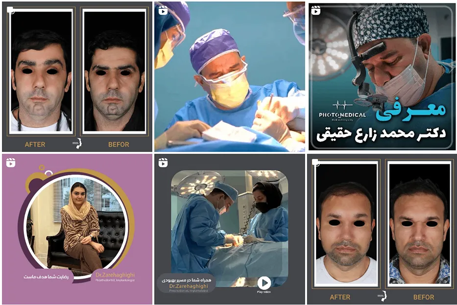 دکتر حقیقی از بهترین دکتر ابدومینوپلاستی در مشهد است