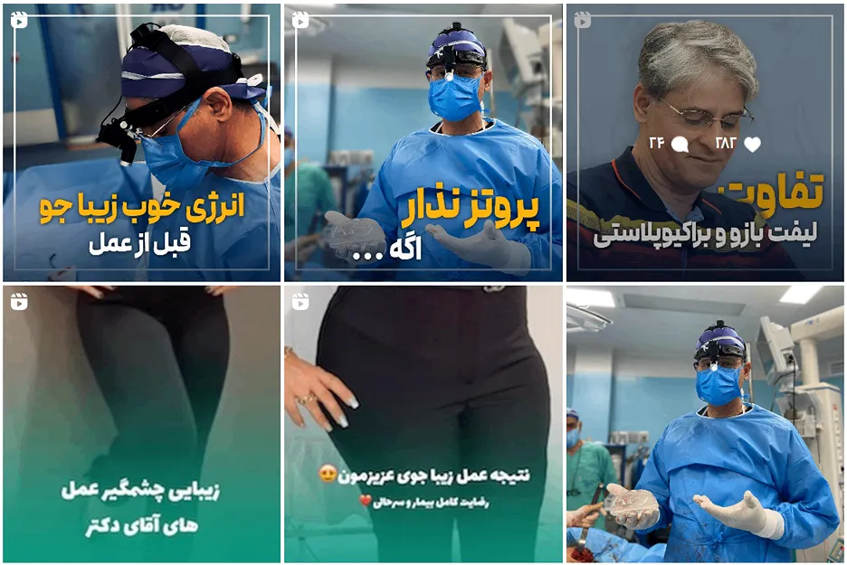 عمل لیپوساکشن در مشهد توسط دکتر حاتمی قابل انجام است