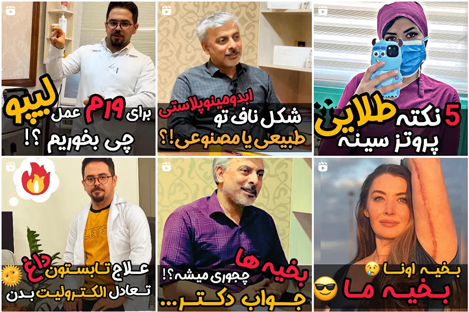 تصویر یکی از بهترین دکتر ماموپلاستی در مشهد را مشاهده میفرمایید.