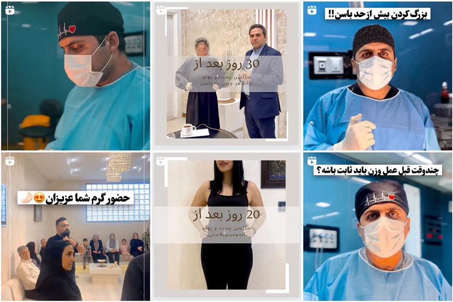 جراحی کوچک کردن سینه مردان در مشهد توسط دکتر جعفری قابل انجام است