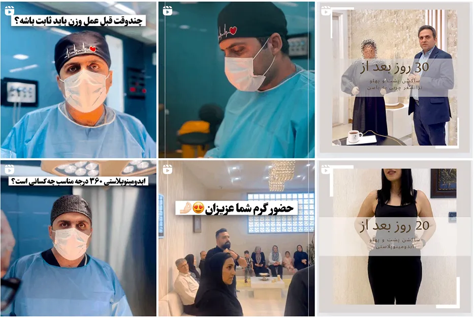 ابدومینوپلاستی در مشهد توسط دکتر جعفری کاملا قابل انجام است